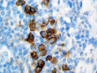 IHC of CD38 Mmab on an FFPE Tonsil Tissue